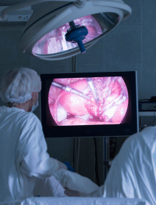 laparoscopy surgery