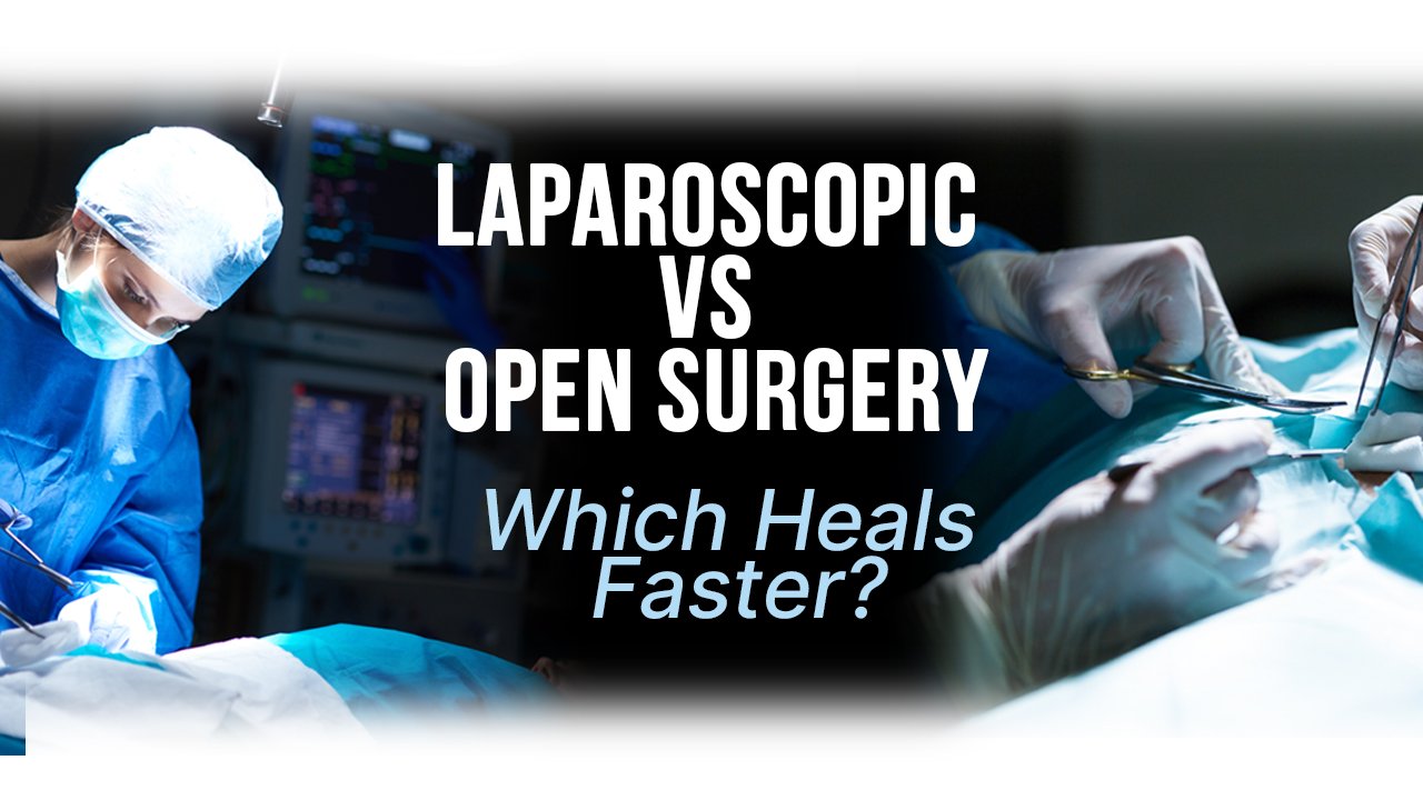 Laparoscopic vs Open Surgery