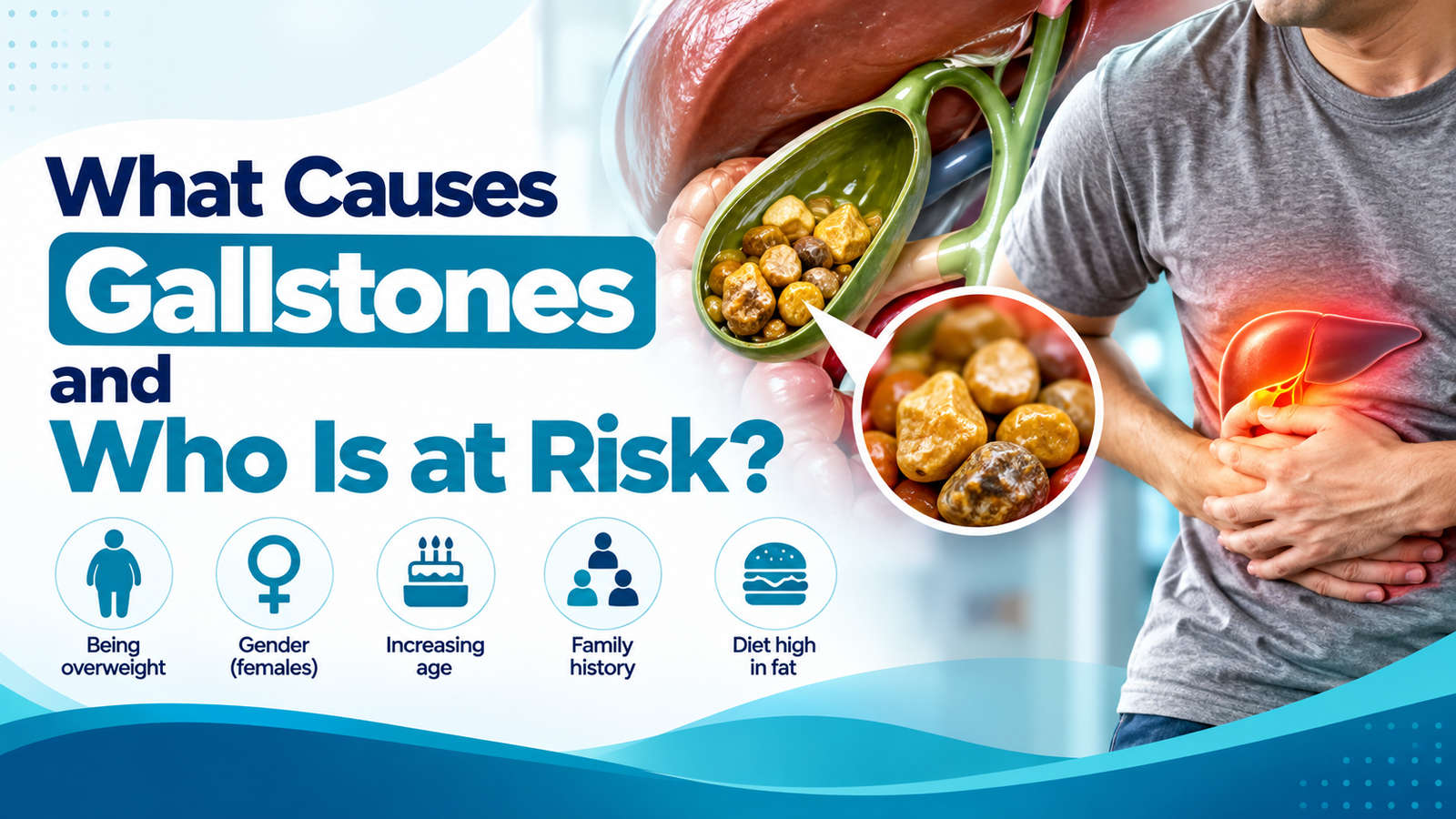 what causes gallstones